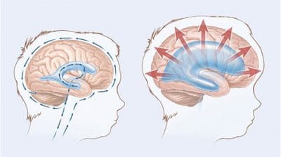 Nöroonkolojik cerrahi ekipmanı (temsili)
